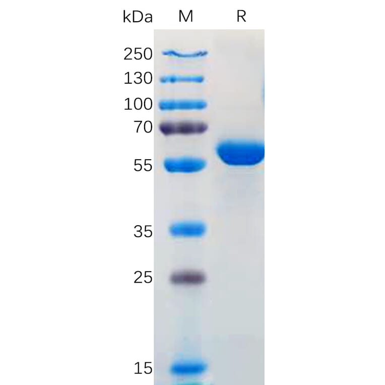 SDS-PAGE - Recombinant SARS-CoV-2 Spike Glycoprotein RBD (Kappa B.1.617/B.1.617.1/B.1.617.3 Variant) (Fc Tag) (A318168) - Antibodies.com