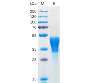 SDS-PAGE - Recombinant Human M-CSF Protein (6×His Tag) (A318169) - Antibodies.com