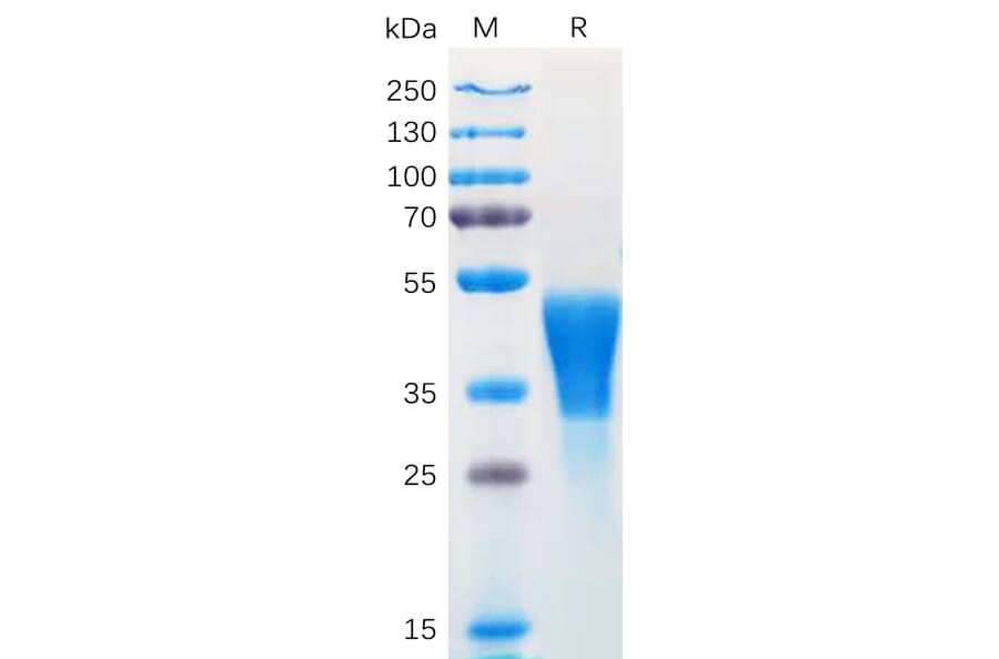 SDS-PAGE - Recombinant Human M-CSF Protein (6×His Tag) (A318169) - Antibodies.com