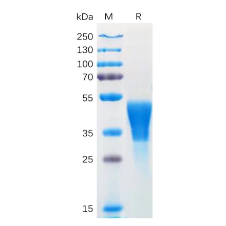 SDS-PAGE - Recombinant Human M-CSF Protein (6×His Tag) (A318169) - Antibodies.com