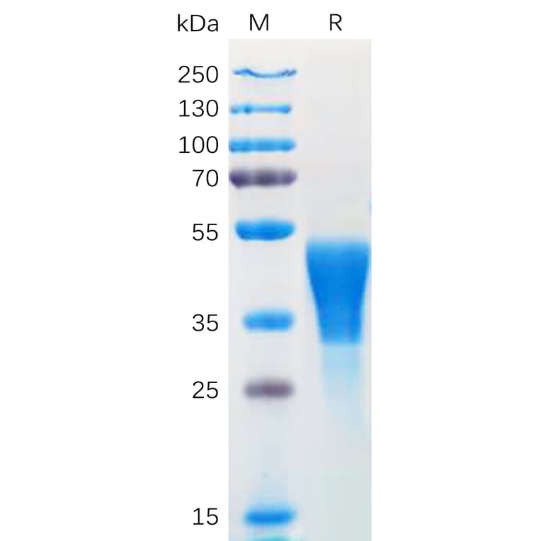 SDS-PAGE - Recombinant Human M-CSF Protein (6×His Tag) (A318169) - Antibodies.com