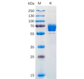 SDS-PAGE - Recombinant Human M-CSF Protein (Fc Tag) (A318170) - Antibodies.com