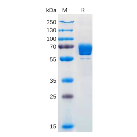 SDS-PAGE - Recombinant Human M-CSF Protein (Fc Tag) (A318170) - Antibodies.com