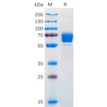 SDS-PAGE - Recombinant Human M-CSF Protein (Fc Tag) (A318170) - Antibodies.com