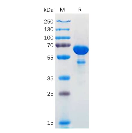 SDS-PAGE - Recombinant Human Bcl-XL Protein (Fc Tag) (A318171) - Antibodies.com