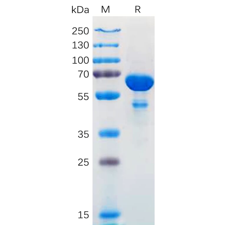 SDS-PAGE - Recombinant Human Bcl-XL Protein (Fc Tag) (A318171) - Antibodies.com