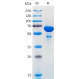 SDS-PAGE - Recombinant Human Bcl-XL Protein (Fc Tag) (A318171) - Antibodies.com