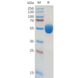 SDS-PAGE - Recombinant Human GM-CSF Protein (Fc Tag) (A318173) - Antibodies.com