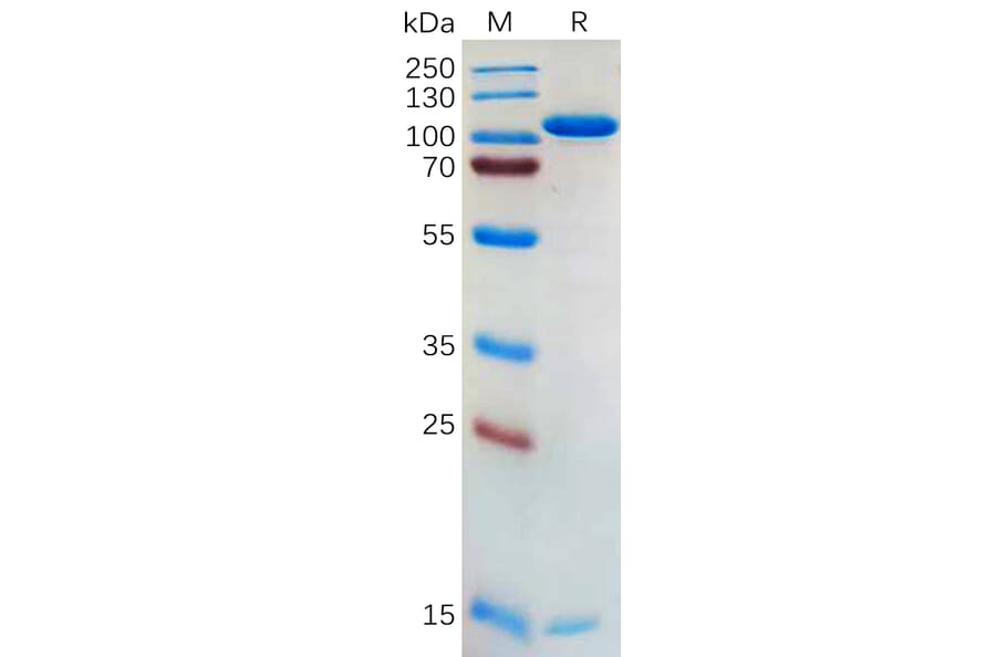 SDS-PAGE - Recombinant Human PCSK9 Protein (Fc Tag) (A318175) - Antibodies.com