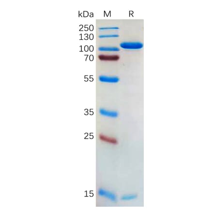 SDS-PAGE - Recombinant Human PCSK9 Protein (Fc Tag) (A318175) - Antibodies.com