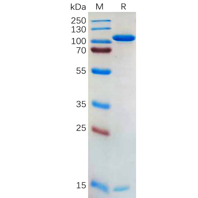 SDS-PAGE - Recombinant Human PCSK9 Protein (Fc Tag) (A318175) - Antibodies.com