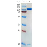 SDS-PAGE - Recombinant Human PCSK9 Protein (Fc Tag) (A318175) - Antibodies.com