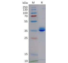 SDS-PAGE - Recombinant Cynomolgus macaque GPCR GPRC5D Protein (Fc Tag) (A318176) - Antibodies.com