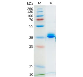 SDS-PAGE - Recombinant Mouse GPCR GPRC5D Protein (Fc Tag) (A318177) - Antibodies.com