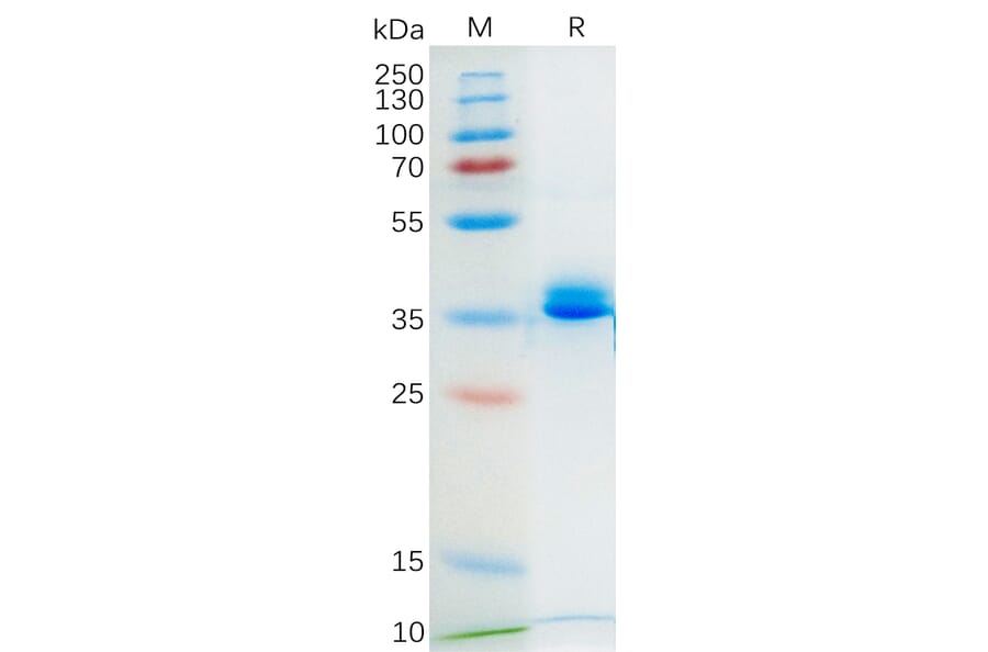 SDS-PAGE - Recombinant Mouse GPCR GPRC5D Protein (Fc Tag) (A318177) - Antibodies.com