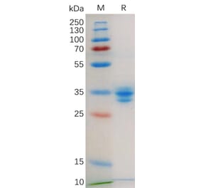 SDS-PAGE - Recombinant Human GPCR GPRC5D Protein (Fc Tag) (A318179) - Antibodies.com