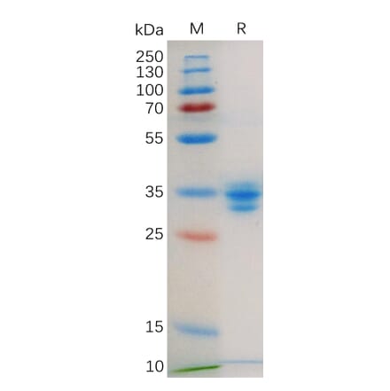 SDS-PAGE - Recombinant Human GPCR GPRC5D Protein (Fc Tag) (A318179) - Antibodies.com