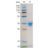 SDS-PAGE - Recombinant Human GPCR GPRC5D Protein (Fc Tag) (A318179) - Antibodies.com