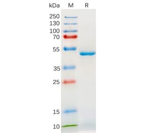 SDS-PAGE - Recombinant Human IL-18 Protein (Fc Tag) (A318180) - Antibodies.com