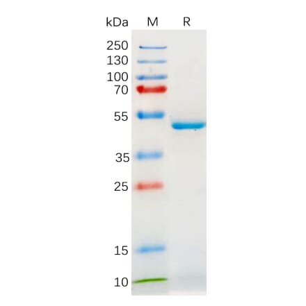 SDS-PAGE - Recombinant Human IL-18 Protein (Fc Tag) (A318180) - Antibodies.com