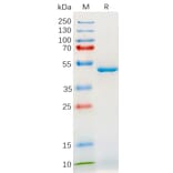 SDS-PAGE - Recombinant Human IL-18 Protein (Fc Tag) (A318180) - Antibodies.com