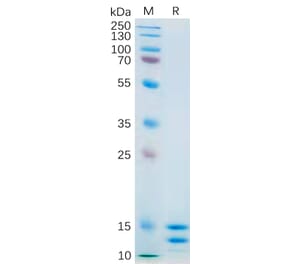 SDS-PAGE - Recombinant Human IL-2 Protein (6×His Tag) (A318181) - Antibodies.com