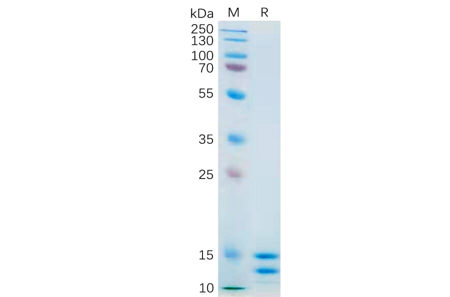 SDS-PAGE - Recombinant Human IL-2 Protein (6×His Tag) (A318181) - Antibodies.com