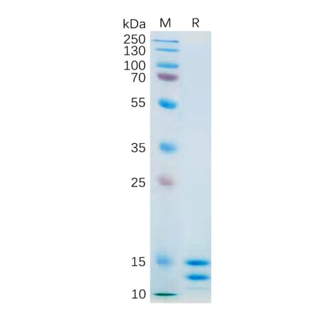 SDS-PAGE - Recombinant Human IL-2 Protein (6×His Tag) (A318181) - Antibodies.com