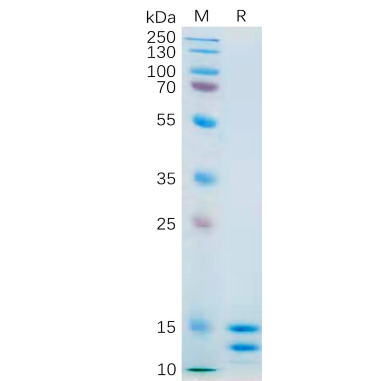 SDS-PAGE - Recombinant Human IL-2 Protein (6×His Tag) (A318181) - Antibodies.com