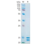 SDS-PAGE - Recombinant Human IL-2 Protein (6×His Tag) (A318181) - Antibodies.com