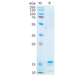 SDS-PAGE - Recombinant Human IL-21 Protein (6×His Tag) (A318182) - Antibodies.com