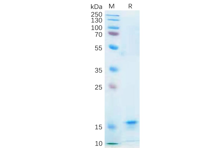 SDS-PAGE - Recombinant Human IL-21 Protein (6×His Tag) (A318182) - Antibodies.com