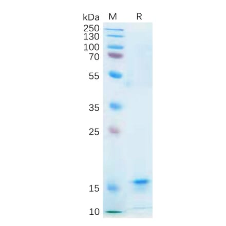 SDS-PAGE - Recombinant Human IL-21 Protein (6×His Tag) (A318182) - Antibodies.com