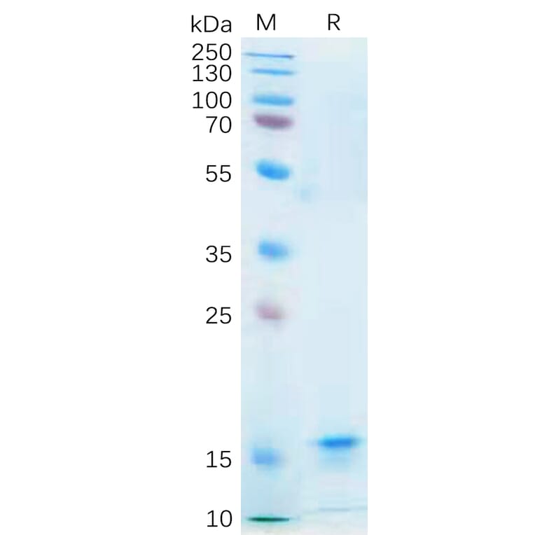 SDS-PAGE - Recombinant Human IL-21 Protein (6×His Tag) (A318182) - Antibodies.com