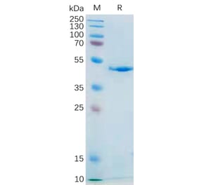 SDS-PAGE - Recombinant Human IL-21 Protein (Fc Tag) (A318183) - Antibodies.com