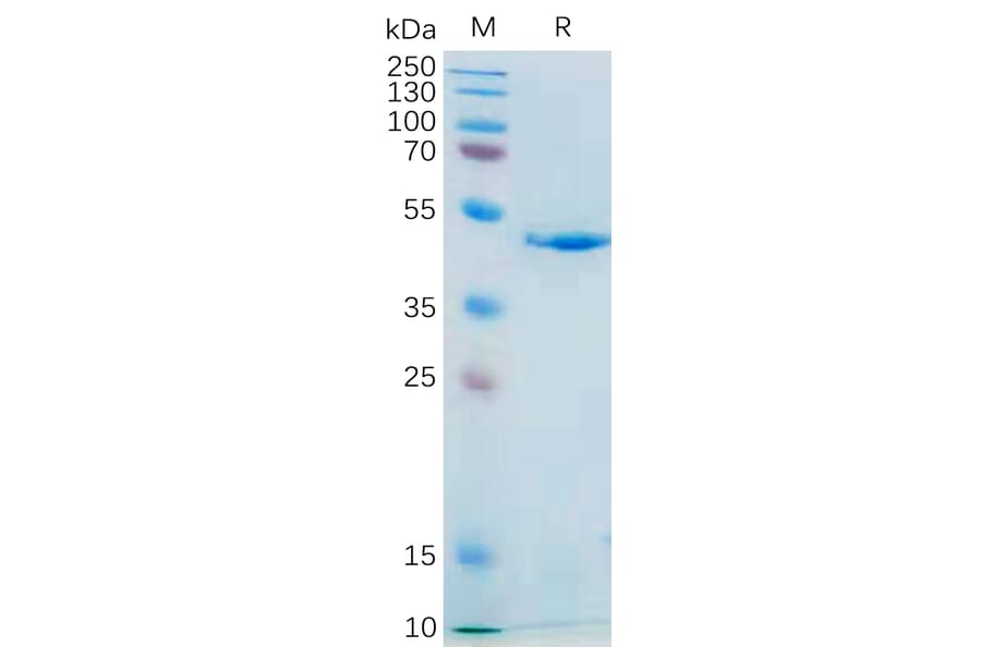 SDS-PAGE - Recombinant Human IL-21 Protein (Fc Tag) (A318183) - Antibodies.com