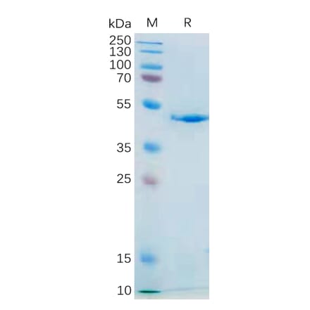 SDS-PAGE - Recombinant Human IL-21 Protein (Fc Tag) (A318183) - Antibodies.com