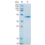 SDS-PAGE - Recombinant Human IL-21 Protein (Fc Tag) (A318183) - Antibodies.com