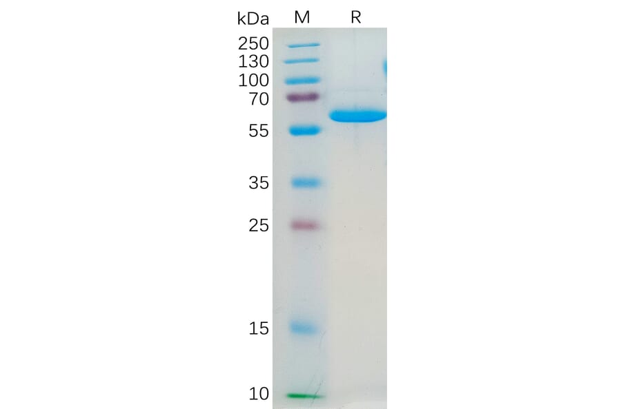 SDS-PAGE - Recombinant Human Junctional Adhesion Molecule 1/JAM-A Protein (Fc Tag) (A318184) - Antibodies.com