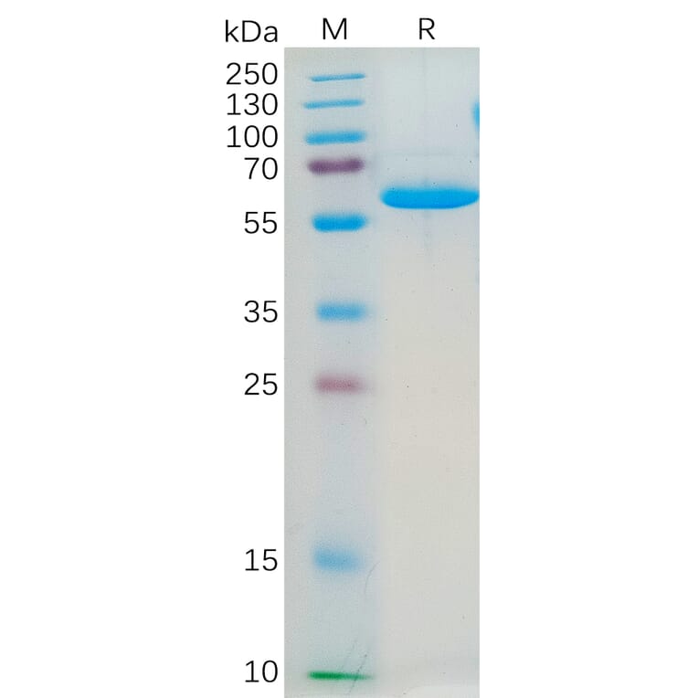 SDS-PAGE - Recombinant Human Junctional Adhesion Molecule 1/JAM-A Protein (Fc Tag) (A318184) - Antibodies.com