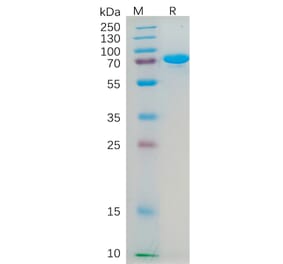SDS-PAGE - Recombinant Human Nectin 2 Protein (Fc Tag) (A318185) - Antibodies.com
