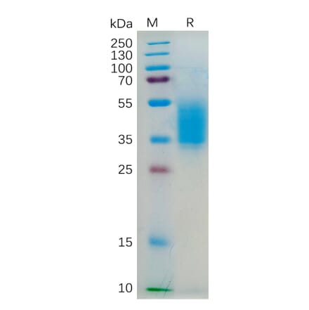 SDS-PAGE - Recombinant Human IL-4R Protein (6×His Tag) (A318186) - Antibodies.com