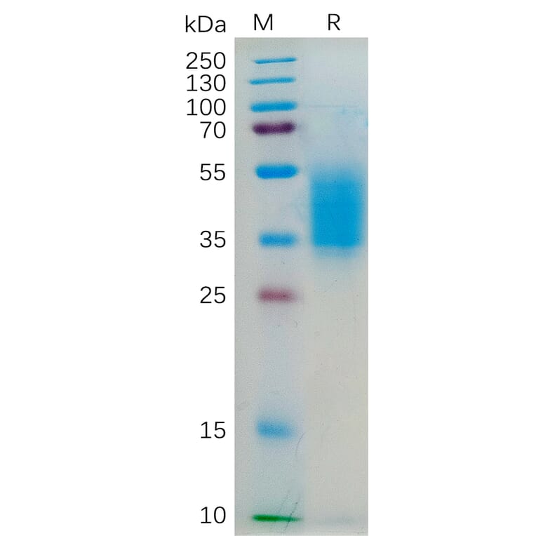 SDS-PAGE - Recombinant Human IL-4R Protein (6×His Tag) (A318186) - Antibodies.com