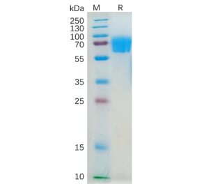 SDS-PAGE - Recombinant Human IL-4R Protein (Fc Tag) (A318187) - Antibodies.com