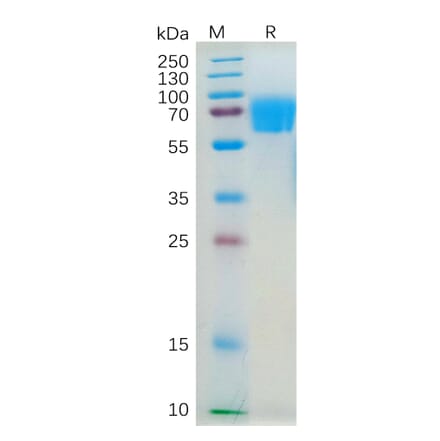 SDS-PAGE - Recombinant Human IL-4R Protein (Fc Tag) (A318187) - Antibodies.com