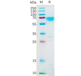 SDS-PAGE - Recombinant Human M-CSF Protein (Fc Tag) (A318188) - Antibodies.com