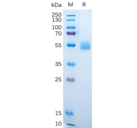 SDS-PAGE - Recombinant Human AMHR2 Protein (Fc Tag) (A318189) - Antibodies.com