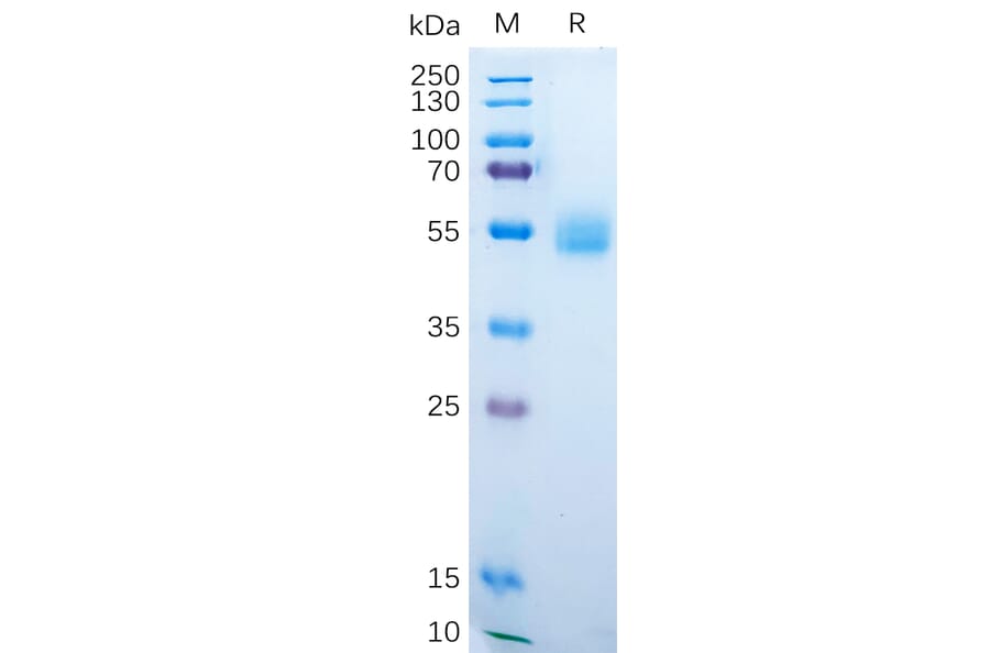 SDS-PAGE - Recombinant Human AMHR2 Protein (Fc Tag) (A318189) - Antibodies.com