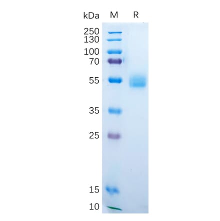 SDS-PAGE - Recombinant Human AMHR2 Protein (Fc Tag) (A318189) - Antibodies.com