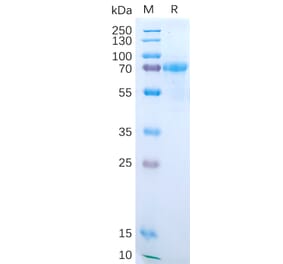 SDS-PAGE - Recombinant Human IL-15RA Protein (Fc Tag) (A318190) - Antibodies.com